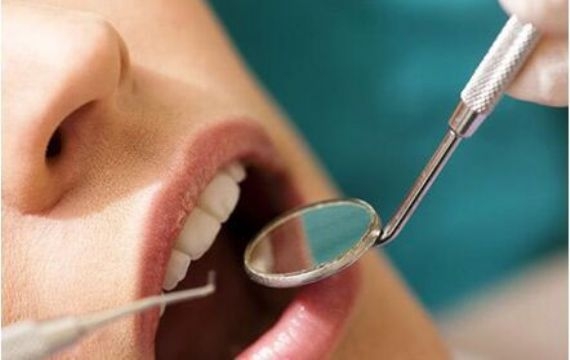 牙龈炎冲洗器的使用方法及功能效果