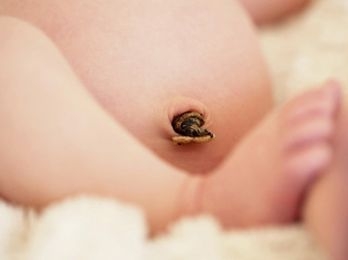 新生儿脐带护理的方法